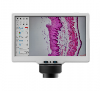7Inch MS Display Camera
